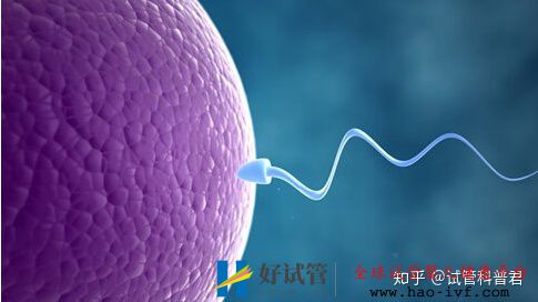 这四种男女,要尽早做试管婴儿,不然晚了后悔死(图9) 这四种男女,要尽早做试管婴儿,不然晚了后悔死(图9)