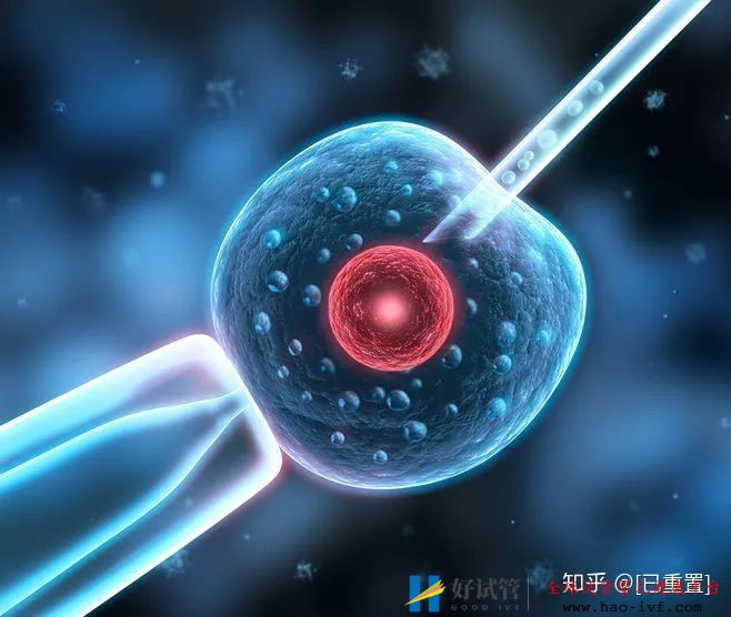 我不建议48岁的你去做试管,除非…(图5) 我不建议48岁的你去做试管,除非…(图5)