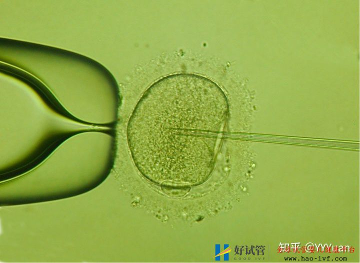 48岁还能做试管婴儿吗(图1) 48岁还能做试管婴儿吗(图1)