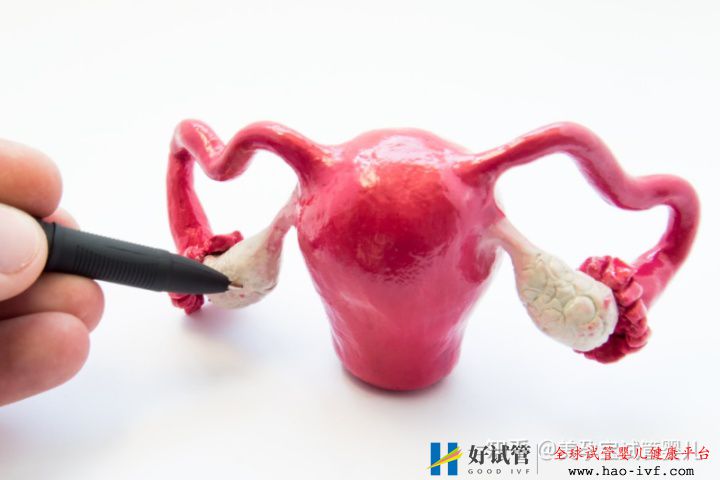 多囊做试管成功率如何不孕不育,多囊国内可以做三...(图1) 多囊做试管成功率如何不孕不育,多囊国内可以做三...(图1)