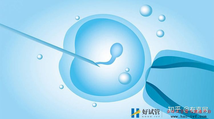 做试管婴儿必须具备的5个条件,你都具备吗(图1) 做试管婴儿必须具备的5个条件,你都具备吗(图1)