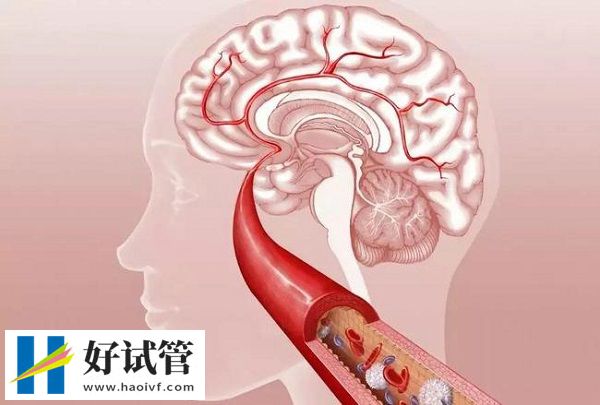 一天吃几粒拜阿司匹灵有讲究,过来人分享正确用法用量(图4) 用拜阿司匹林预防心脑血管病要终身用药