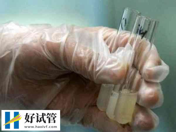 白细胞精子症会影响精子功能