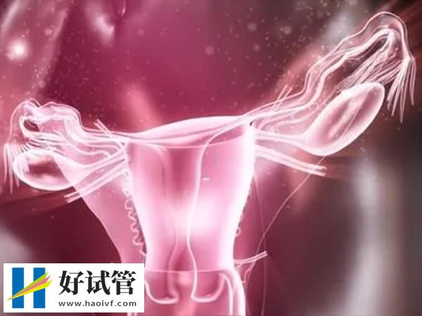 多囊卵巢做试管优势和劣势是什么(图2) 多囊做试管易发生卵巢过度刺激综合征