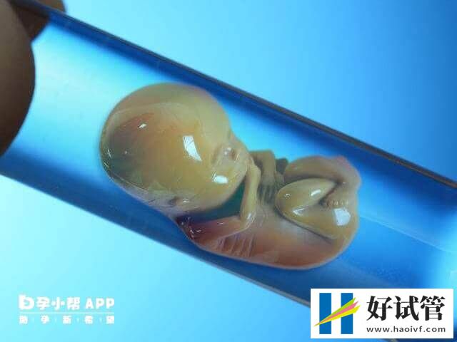 46岁自卵试管成功经验有哪些(图1) 46岁自卵试管成功经验分享