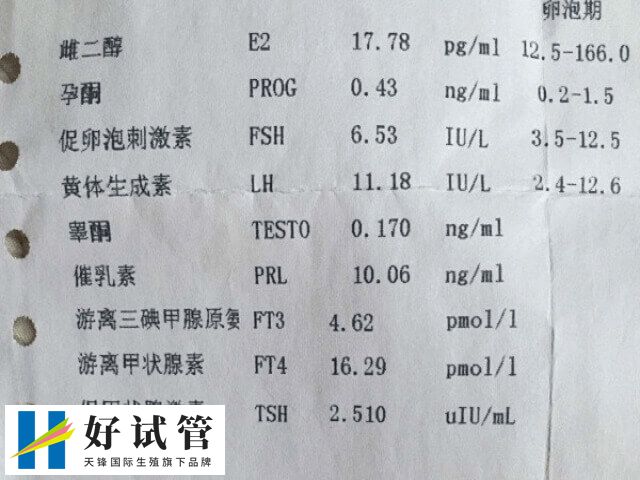 孕酮高要保持规律作息