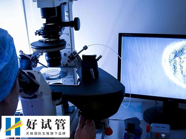 做二代试管婴儿医生凭借经验容易挑到y精子吗?(图1) 二代试管婴儿技术即单精子卵胞浆注射