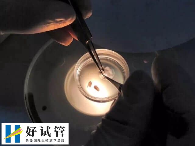 染色体非整倍体怎么办(图1) 胚胎染色体非整倍体是一种较为复杂的情况