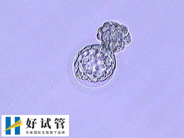 囊胚6AA是优质评级