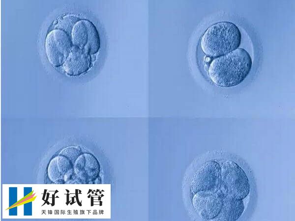 4cc囊胚也能移植成功