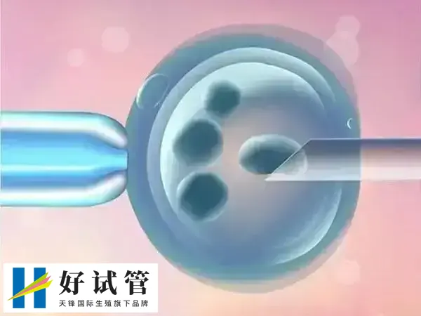 浙大二院做试管婴儿费用要多少(图1) 浙大二院做试管前要先进行身体检查