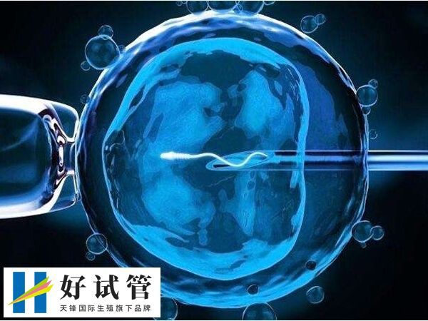 ppos方案促排过程简单